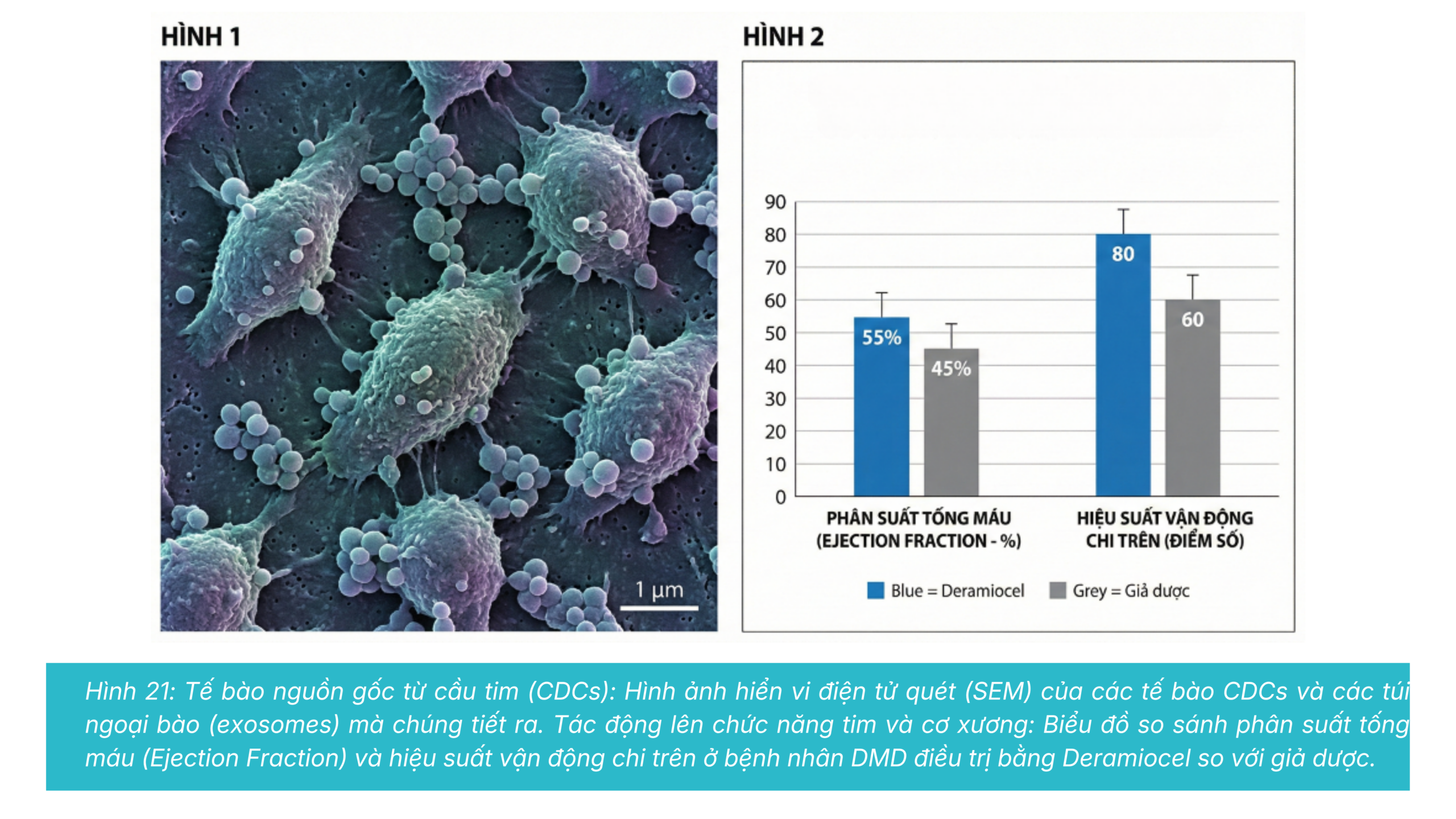 Capricor Therapeutics: Hy Vọng Mới Cho Bệnh Cơ Tim DMD