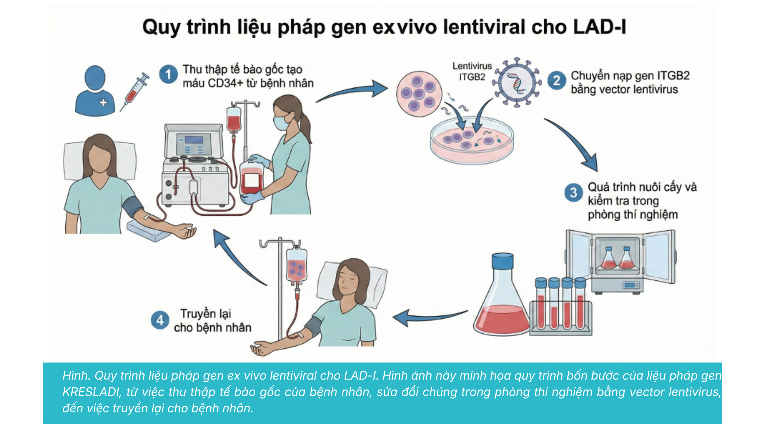Rocket Pharmaceuticals và KRESLADI: Đếm Ngược Ngày PDUFA
