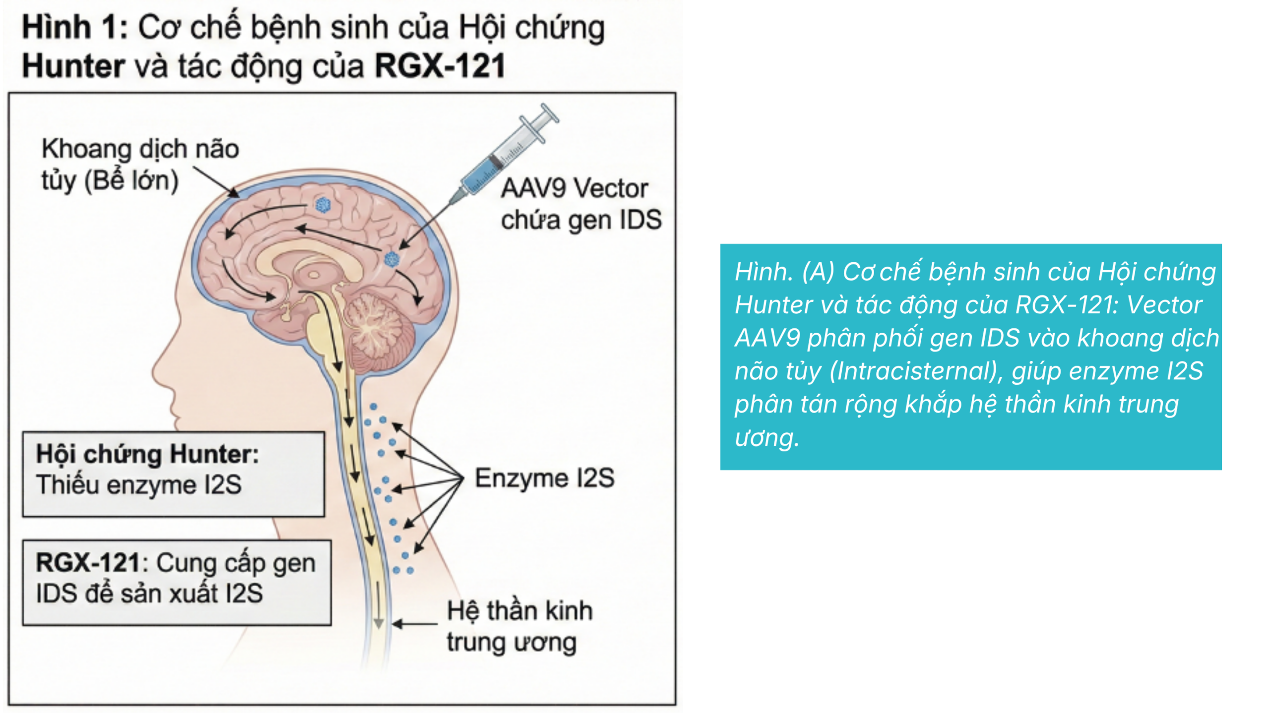 Bài Học Từ Regenxbio: Thách Thức Của Điểm Cuối Thay Thế Trong Bệnh Thần Kinh
